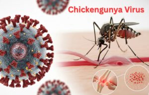 Chikungunya ở Việt Nam: Dấu hiệu & Cách Nhận Biết Sớm